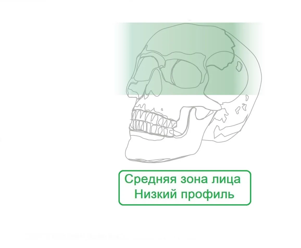 Средняя зона Пластины Миди NL с низким профилем
