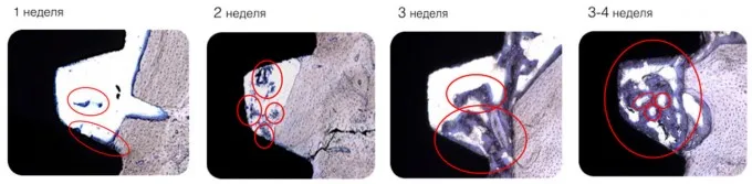 Гистология имплантатов mis c1