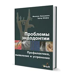 Проблемы эндодонтии. Профилактика, выявление и устранение