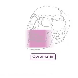 Ортогнатия Пластины Мини