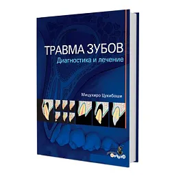 Травма зубов. Диагностика и лечение