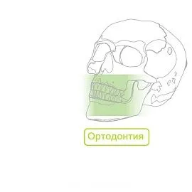 Ортодонтия Якорные небные пластины