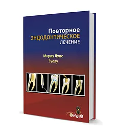 Повторное эндодонтическое лечение