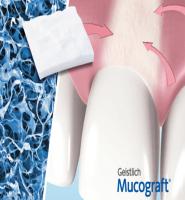 Применение матрикса Mucograft