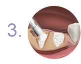 Инструкция 4Bone