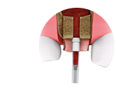 Спецификация 4Bone