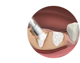 Спецификация 4Bone
